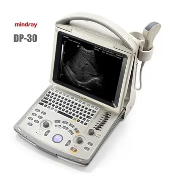 Медицински ултразвукови инструменти Mindray DP-30, ултразвуков скенер, преносим лаптоп, ултразвукови изследвания